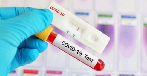 В Харькове зафиксировано 896 случаев заболевания коронавирусом