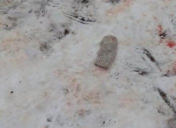 Страшная смерть малыша: собственная собака загрызла 4-летнего мальчика (ФОТО)