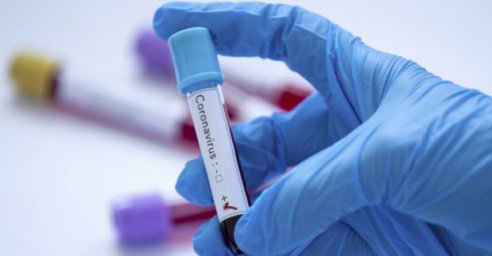 В Харькове - 406 больных коронавирусом