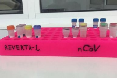 У 31 жителя Харьковщины - подозрение на COVID-19
